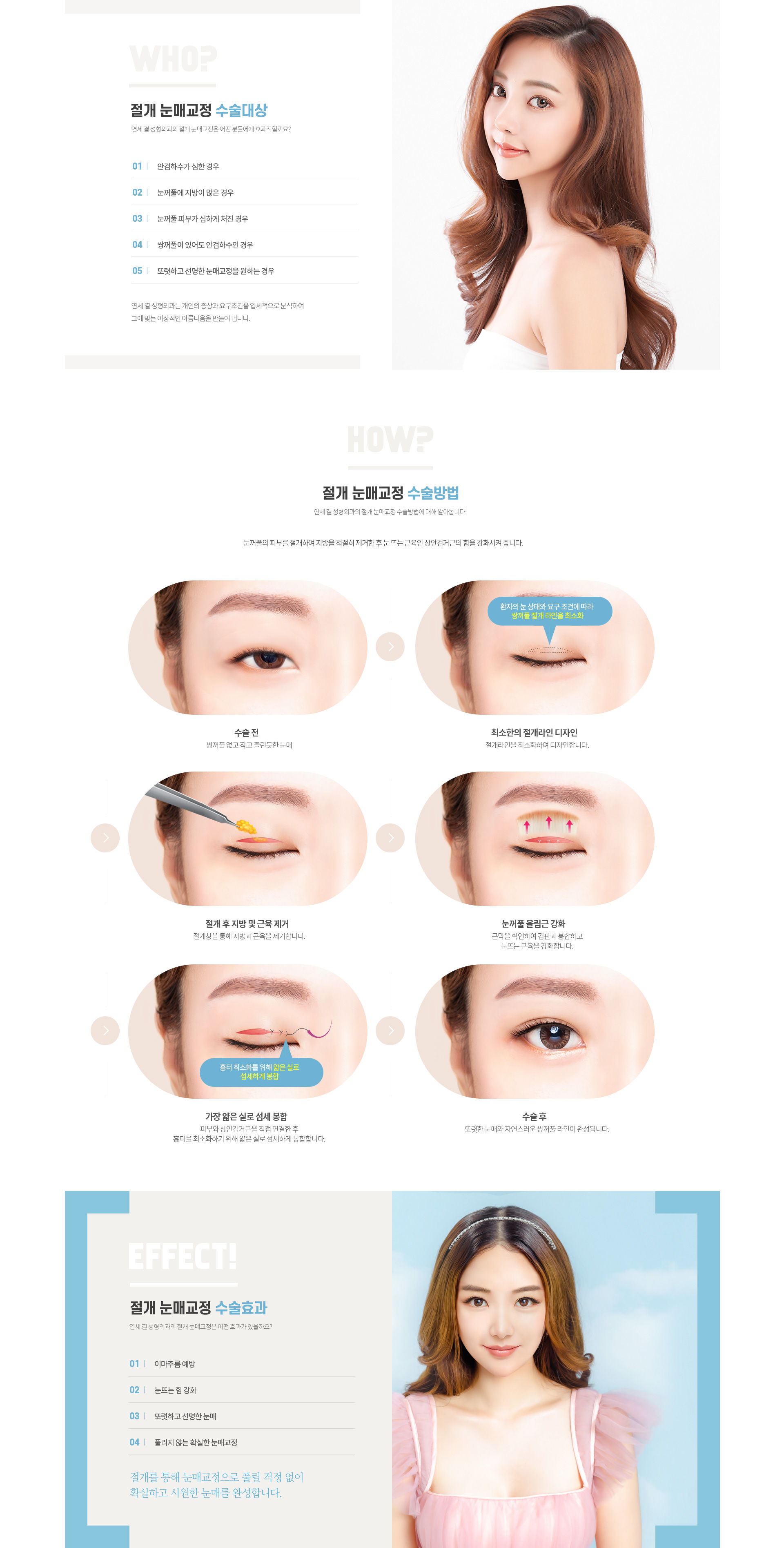 연세결성형외과 눈성형 절개눈매교정 대상 방법 효과