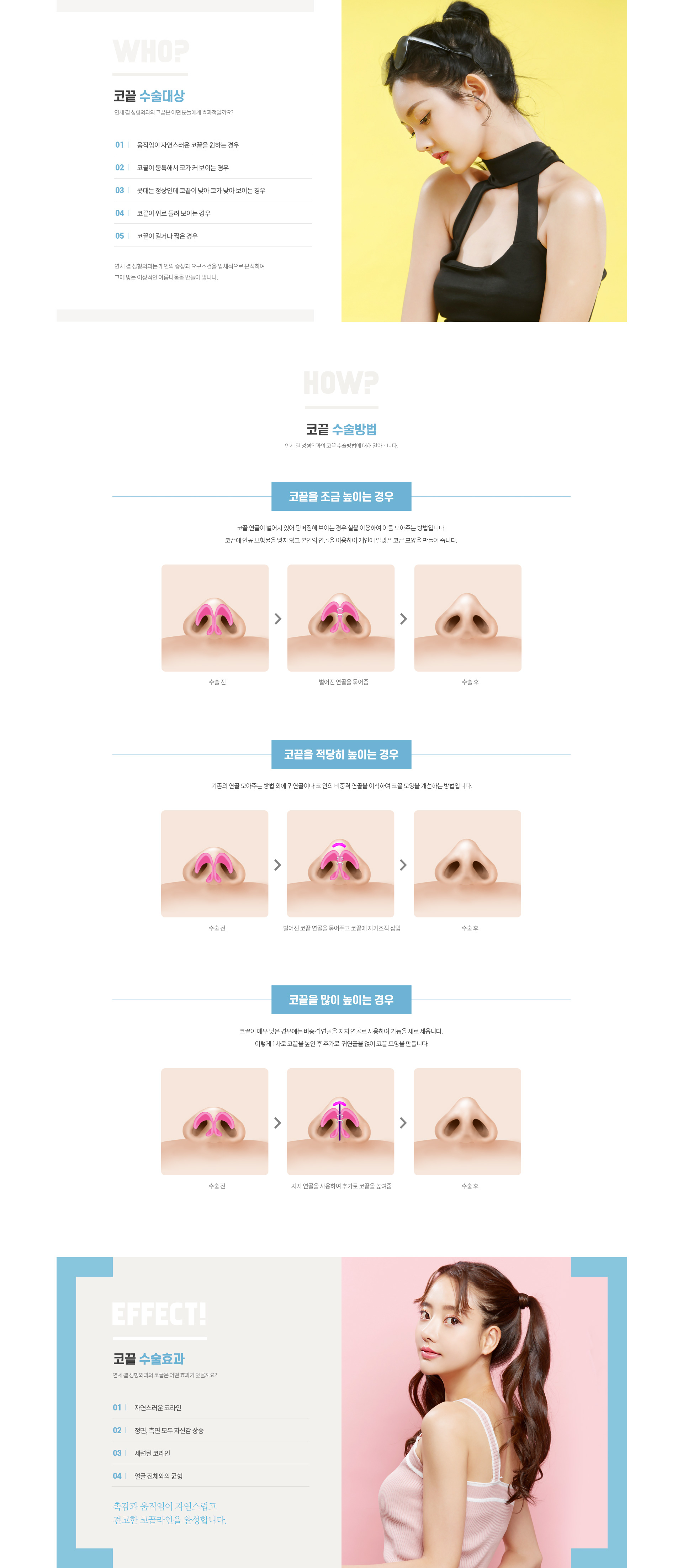 연세결성형외과 코성형 미용코성형 코끝 대상 방법 효과