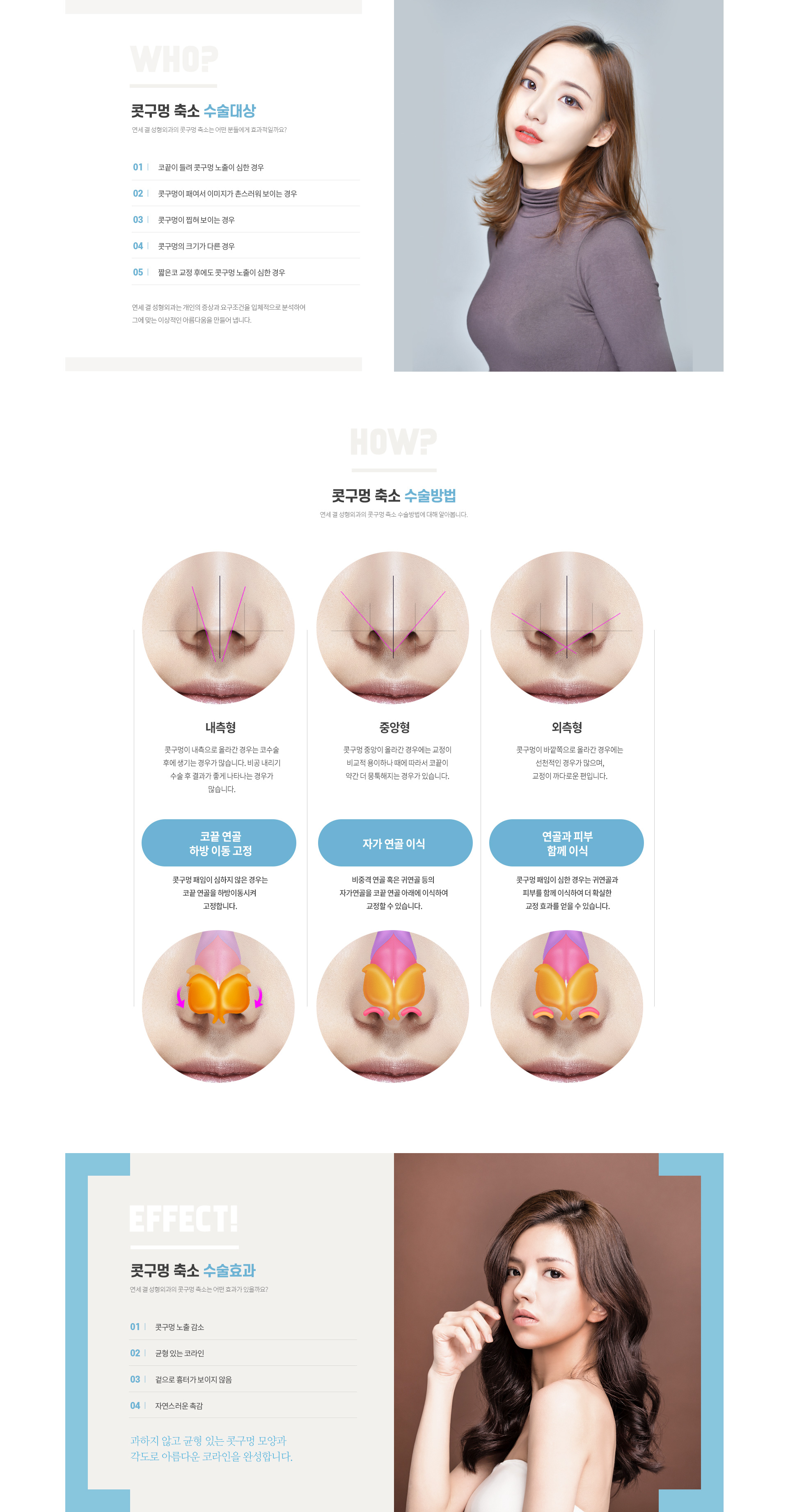 연세결성형외과 코성형 미용코성형 콧구멍축소 대상 방법 효과