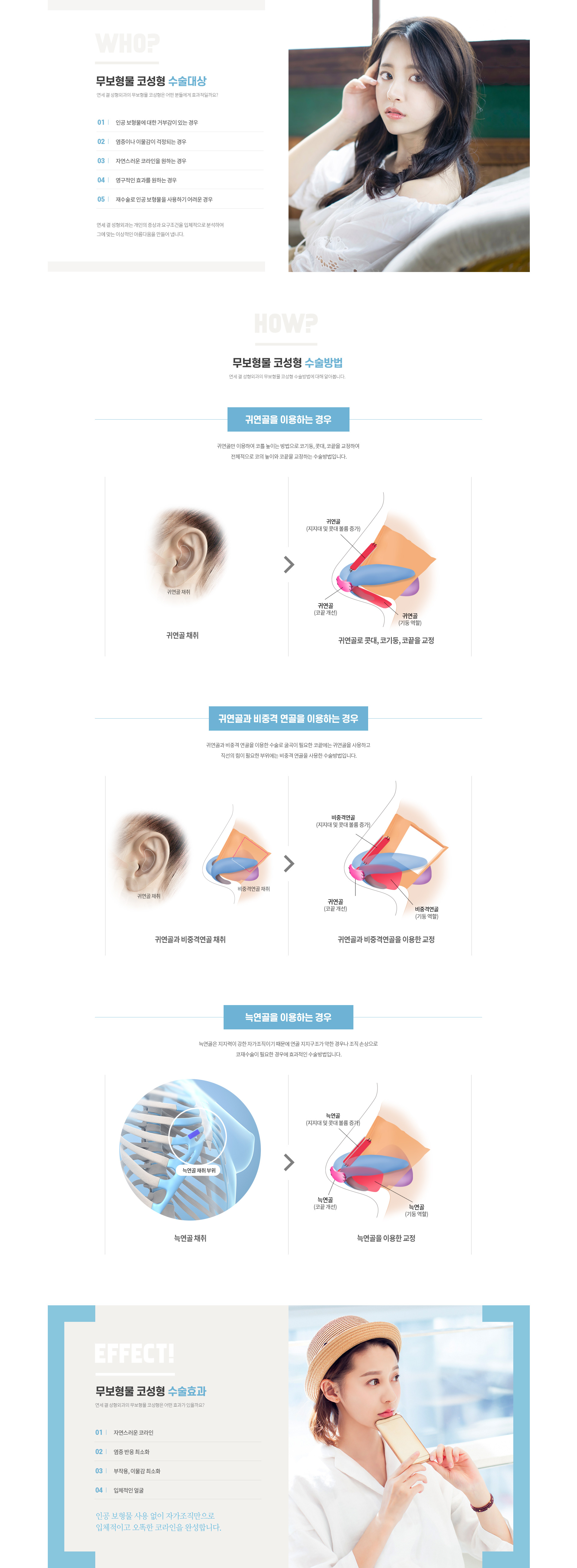 연세결성형외과 코성형 무보형물 코성형 대상 방법 효과